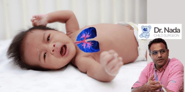 What is Lung Malformation in children -  causes, symptoms & treatment in Malaysia